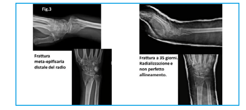 operazione urso 2 operazione urso 2