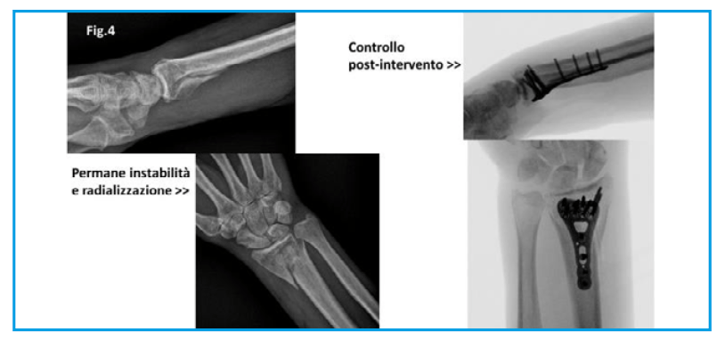 operazione urso 3 operazione urso 3