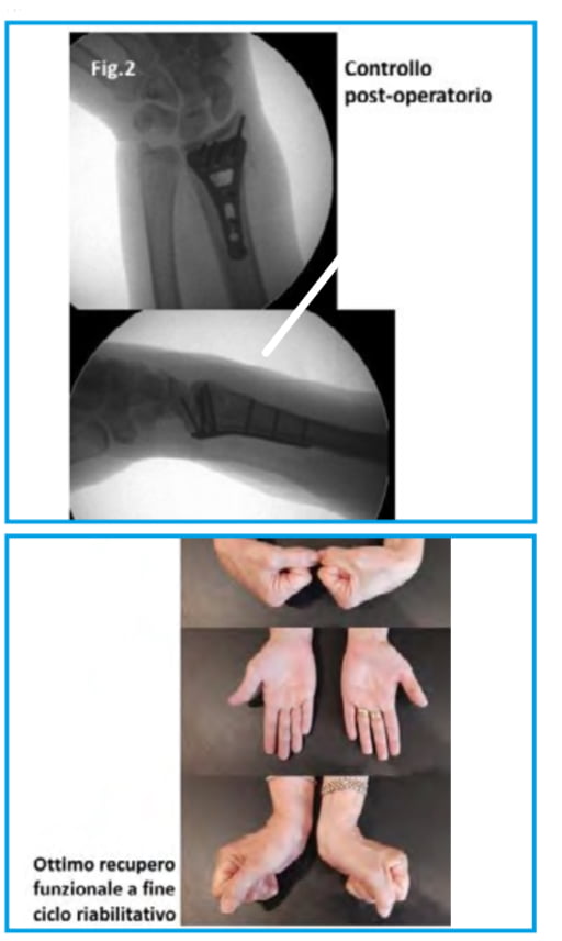 operazione urso 4 operazione urso 4