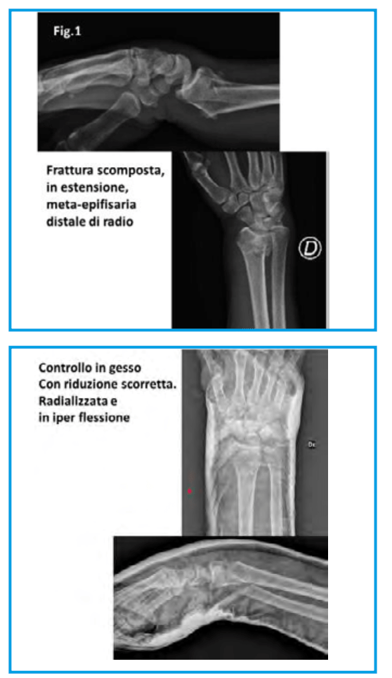 operazione urso operazione urso