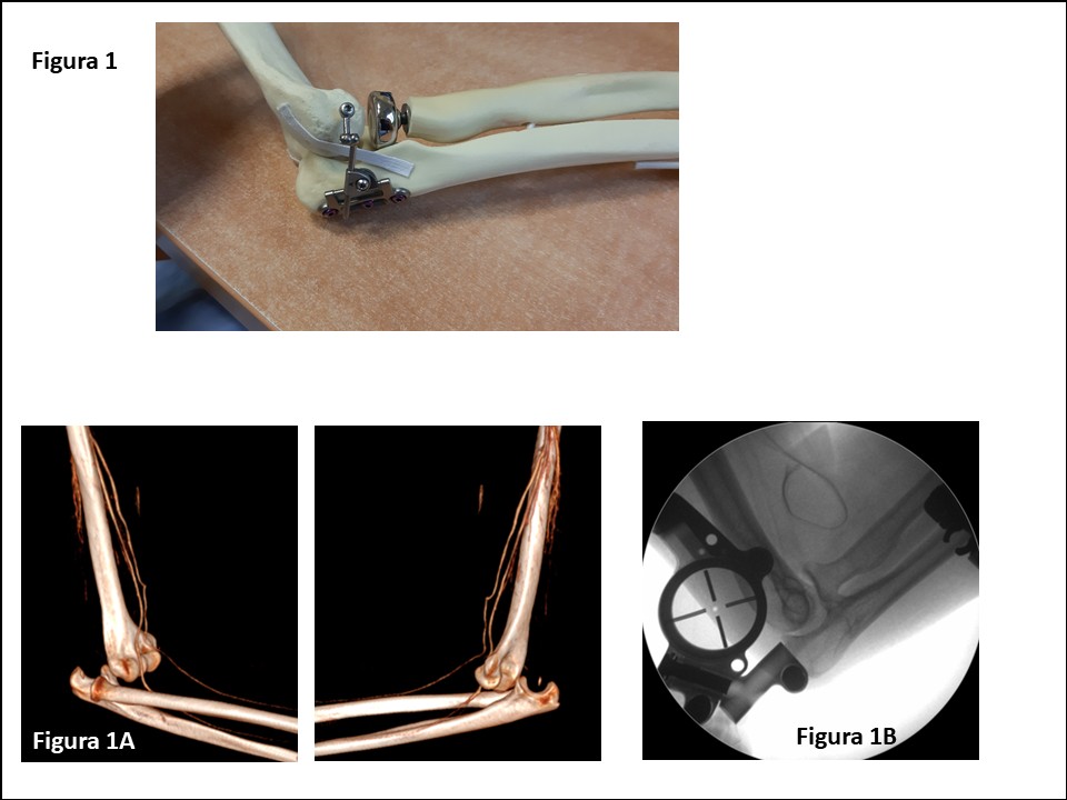Diapositiva1
